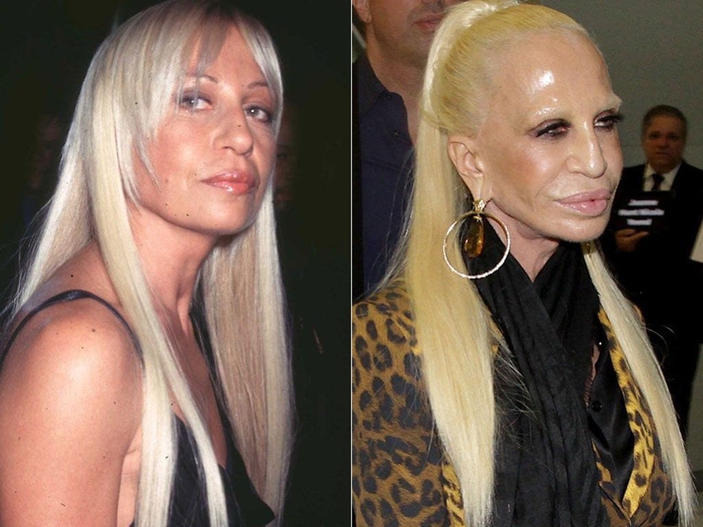 Celebs Who Totally Transformed Over The Years Donatella Versace – Age 66