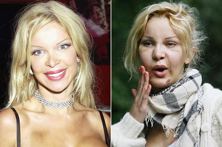 Celebs Who Totally Transformed Over The Years Alicia Douvall – Age 41
