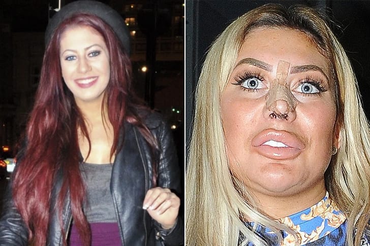 Celebs Who Totally Transformed Over The Years Chloe Ferry – Age 25