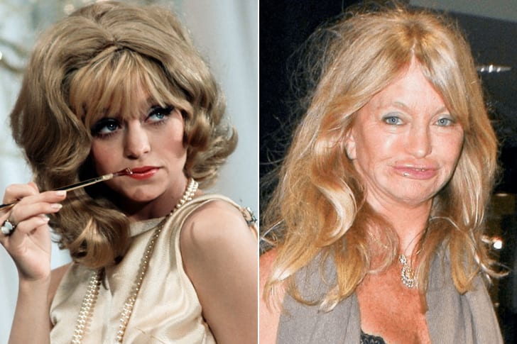 Celebs Who Totally Transformed Over The Years  Goldie Hawn – Age 75