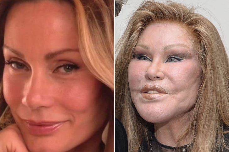Celebs Who Totally Transformed Over The Years Jocelyn Wildenstein – Age 75