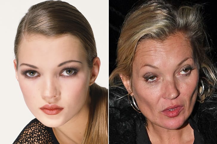 Celebs Who Totally Transformed Over The Years Kate Moss – Age 47
