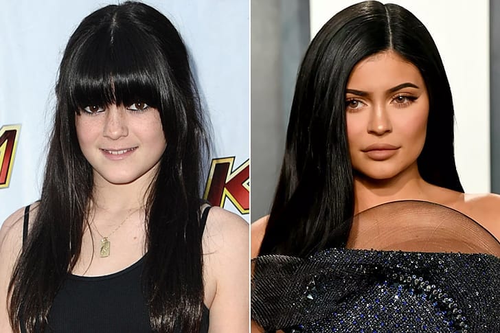 Celebs Who Totally Transformed Over The Years Kylie Jenner – Age 23