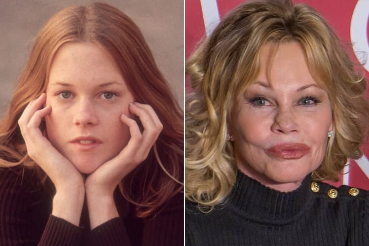 Celebs Who Totally Transformed Over The Years Melanie Griffith – Age 63