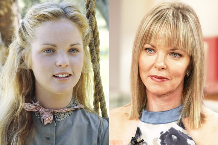 Celebs Who Totally Transformed Over The Years Melissa Sue Anderson – Age 58