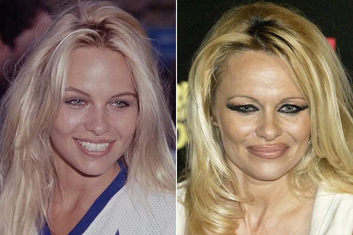 Celebs Who Totally Transformed Over The Years Pamela Anderson – Age 53