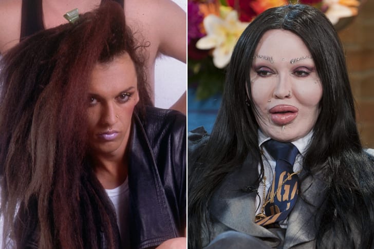 Celebs Who Totally Transformed Over The Years Pete Burns – Age 57