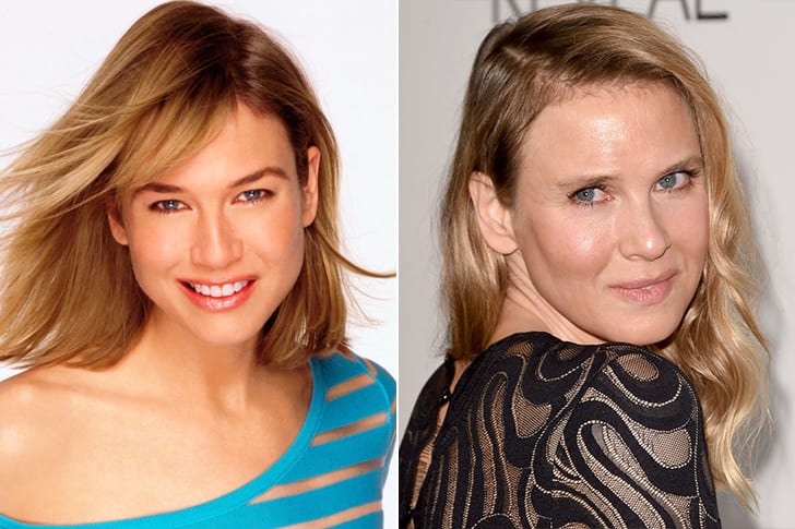 Celebs Who Totally Transformed Over The Years Renee Zellweger – Age 52