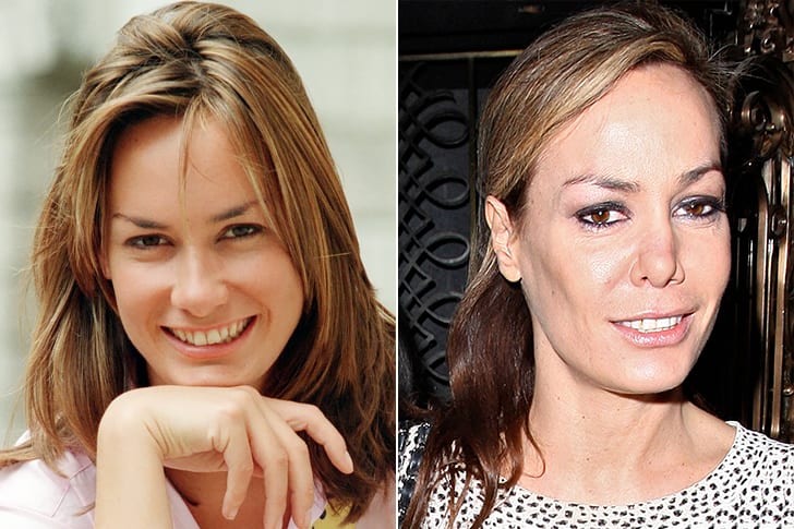 Celebs Who Totally Transformed Over The Years Tara Palmer-Tomkinson – Age 45