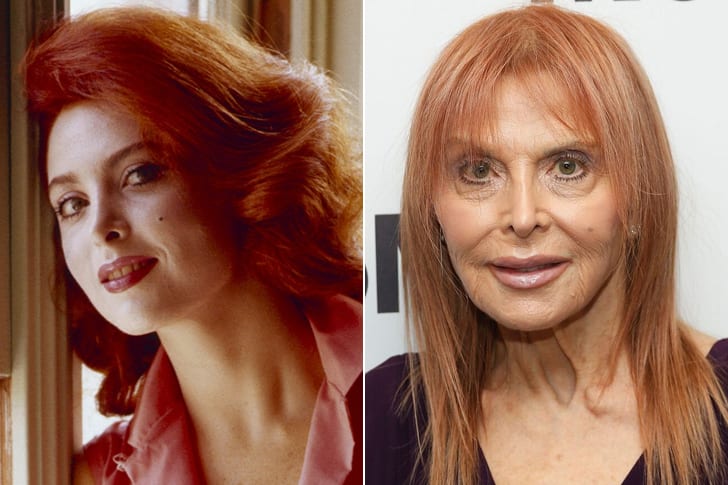 Celebs Who Totally Transformed Over The Years Tina Louise – Age 87