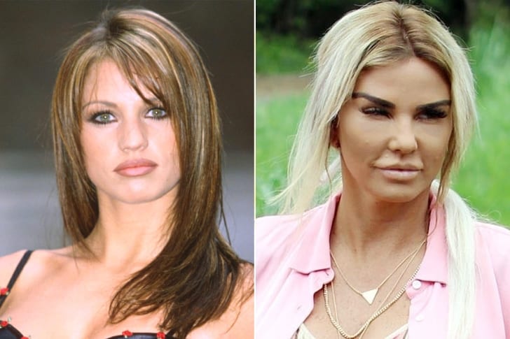 Celebs Who Totally Transformed Over The Years Katie Price – Age 43