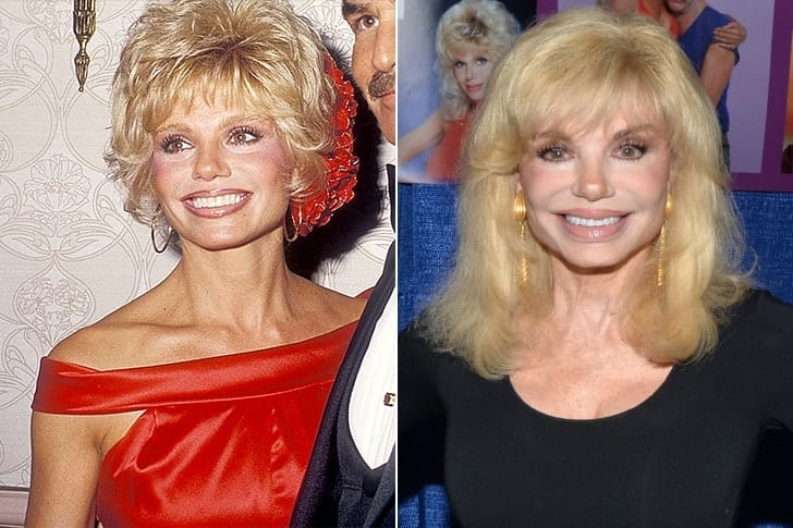 Golden Age Stars Who Are Still Alive & Kicking Hard Loni Anderson, 75 – $12 Million